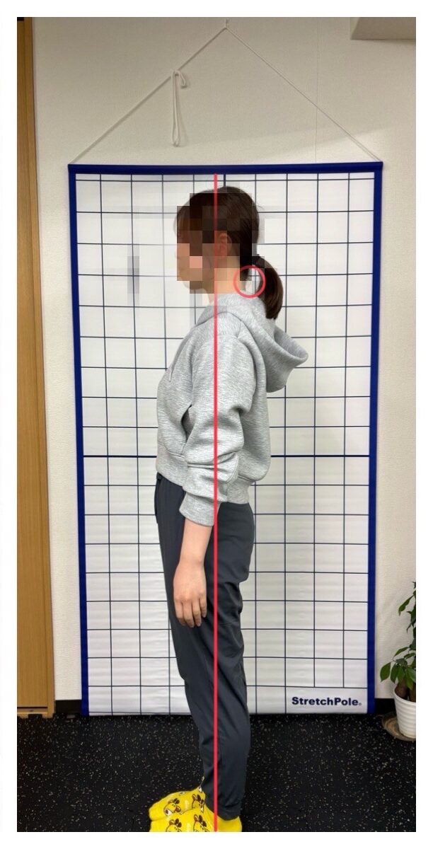 After